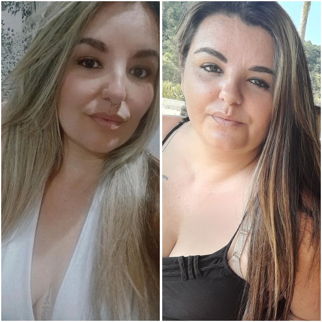 Antes e depois 2